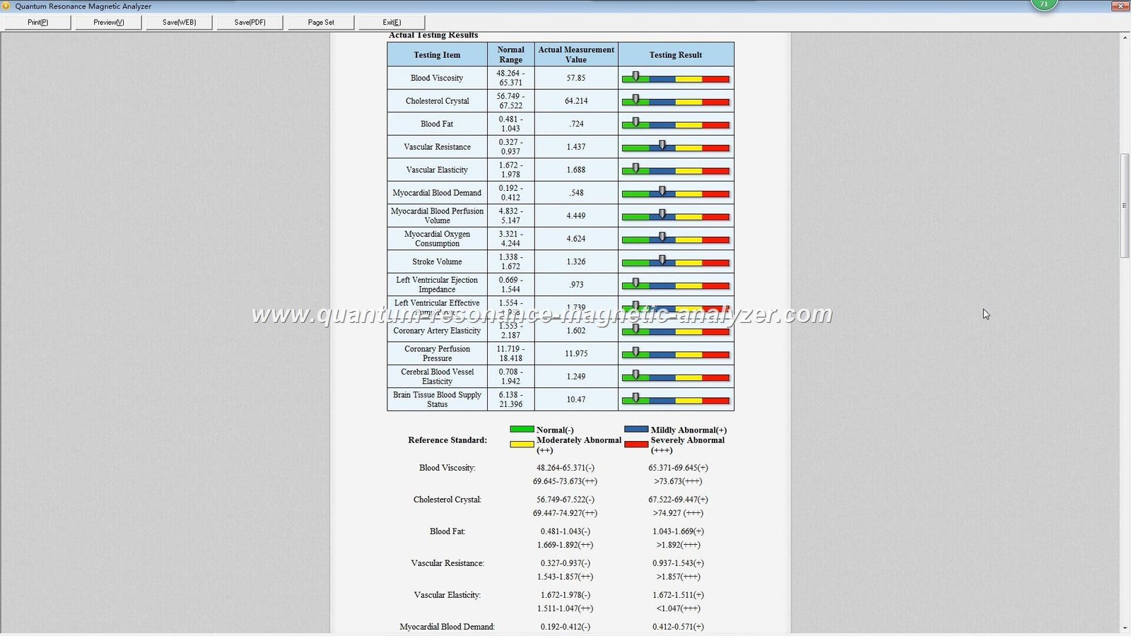 Sample quantum resonance magnetic analyzer health report showing multiple organ systems analysis